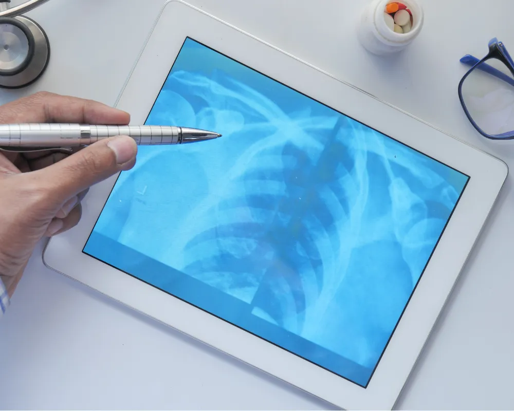 Doctor reviewing a digital X-ray on a tablet